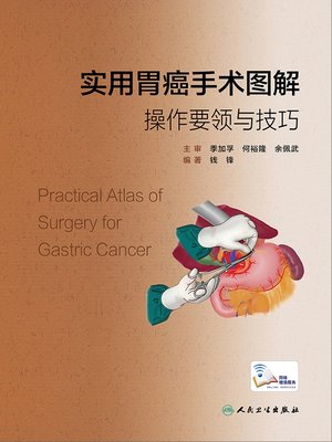 cover image of 实用胃癌手术图解